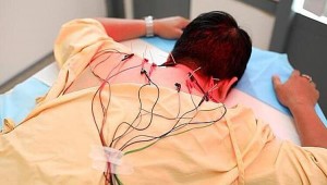 Kỹ thuật điện châm điều trị hội chứng đau vai gáy